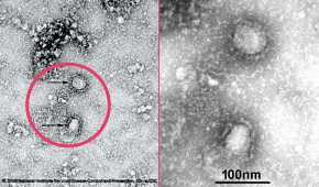 Estas son las primeras imágenes del virus que surgió en China