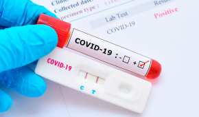 Un nuevo estudio reveló que las personas que sobrevivieron a COVID-19 podrían tener anticuerpos de por vida