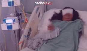 Debido al ataque de los 3 perros, la deportista ya perdió uno de sus brazos